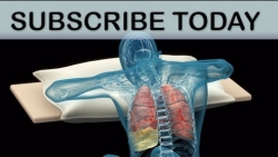 Trinsic Medical Animation: Introduction